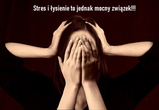 Stres i łysienie to jednak mocny związek