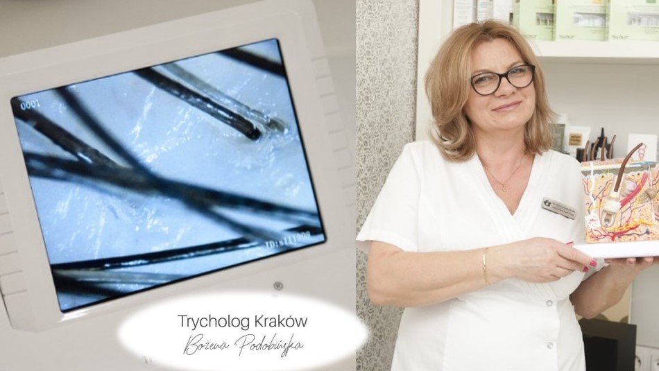Trycholog – kiedy potrzebny?